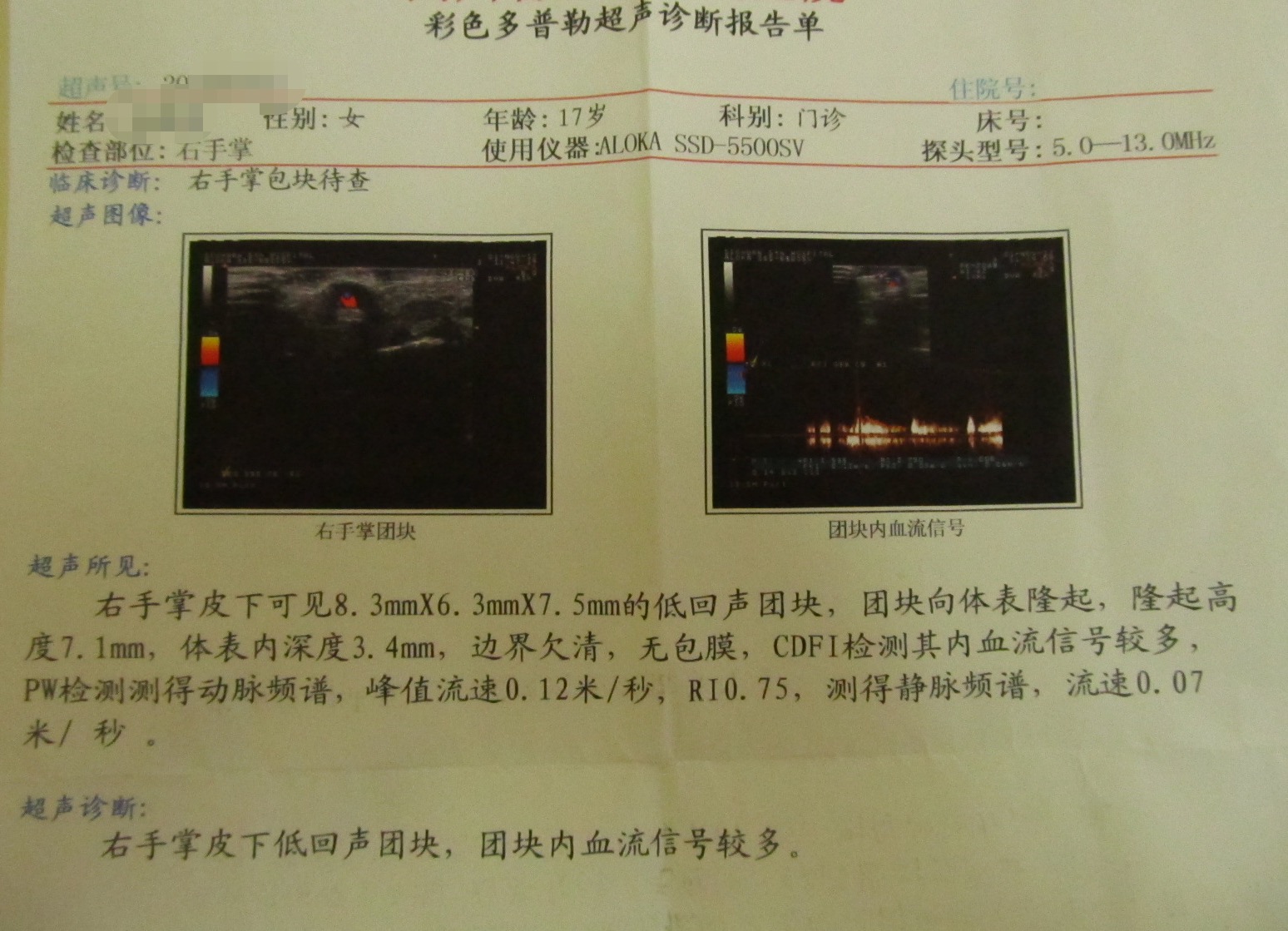大家帮忙看下彩超报告_血管瘤论坛-中国血管瘤患者之家