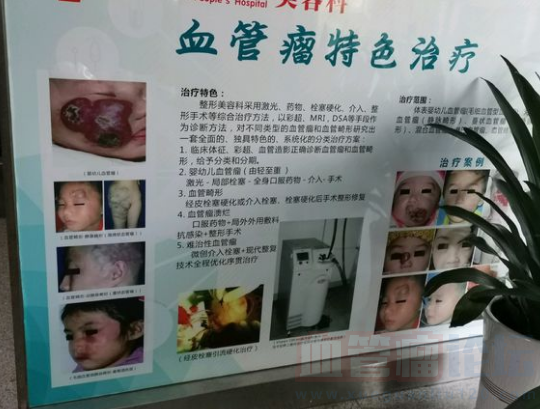 激光治疗血管瘤后起泡，还有什么更好的方法能让孩子少....._血管瘤论坛-中国血管瘤患者之家