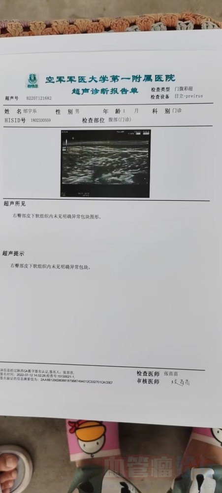 血管瘤_血管瘤论坛-中国血管瘤患者之家