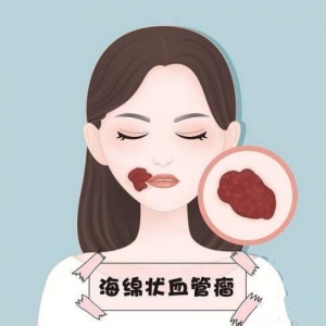 海绵状血管瘤的硬化治疗_血管瘤论坛-中国血管瘤患者之家