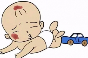 为什么婴儿容易患上血管瘤呢?_血管瘤论坛-中国血管瘤患者之家